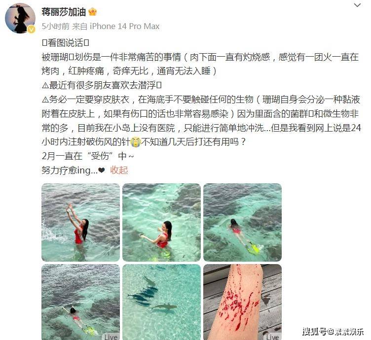 蒋丽莎游泳被珊瑚划伤：现场鲜血直流，求助网友打破伤风针的时间